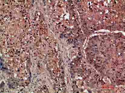 a01698 ddr2 primary antibodyes ihc testing 2