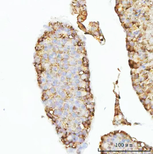  IHC analysis of GHRH using anti-GHRH antibody (A01699-1)