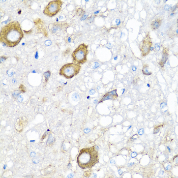 Immunohistochemistry of paraffin-embedded rat breast using MGP Rabbit pAb  at dilution of 1:100 