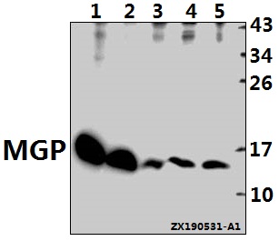 Western blot (WB) analysis of MGP pAb at 1:500 dilution
Lane1:CT26 whole cell lysate(20ug)
Lane2:H9C2 whole cell lysate(40ug)
Lane3:Hela whole cell lysate(40ug)
Lane4:MCF-7 whole cell lysate(40ug)
Lane5:PC3 whole cell lysate(40ug)