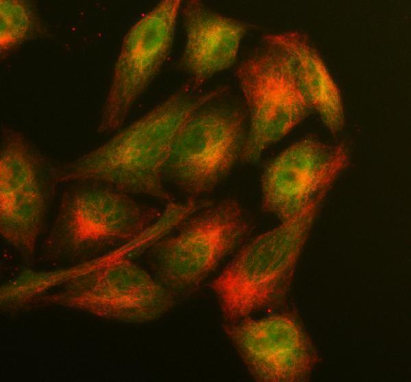 a01703 1 glo1 primary antibodies if testing 1