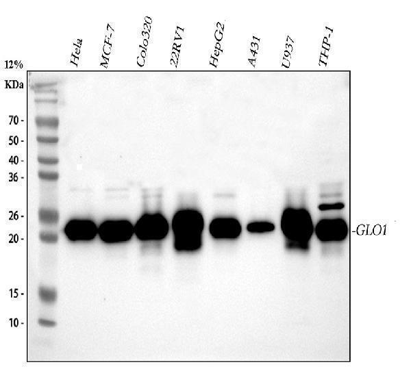  Western blot analysis of GLO1 using anti-GLO1 antibody (A01703-1)