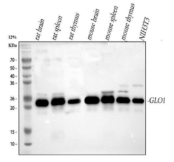  Western blot analysis of GLO1 using anti-GLO1 antibody (A01703-1)