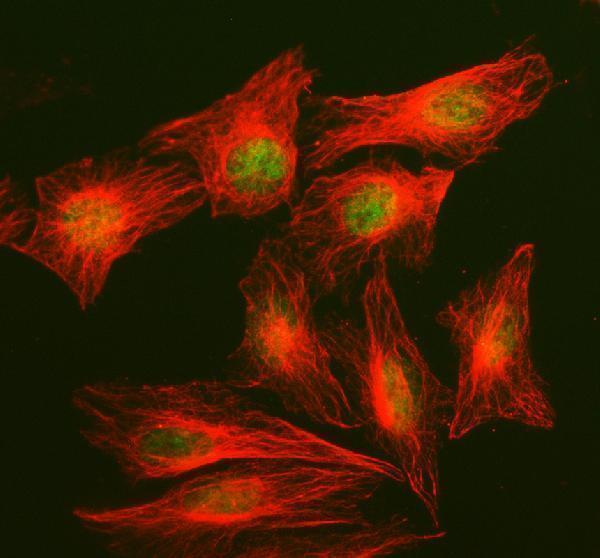 a01706 2 ncoa2 primary antibodies if testing 4