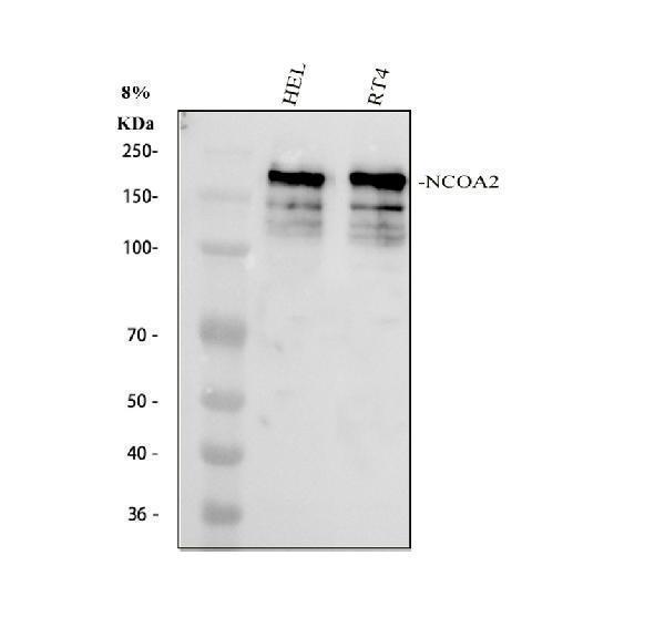  Western blot analysis of NCOA2 using anti-NCOA2 antibody (A01706-2)