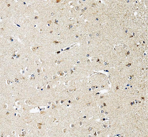a01711 1 adcyap1 primary antibodies ihc testing 1