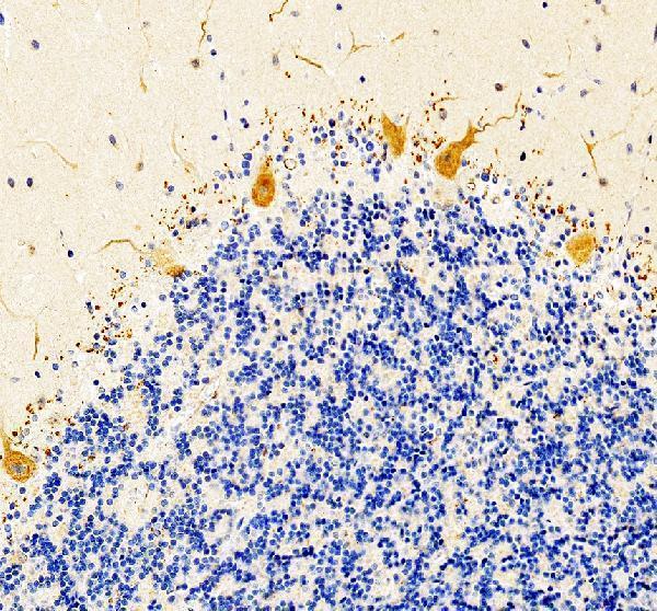 a01711 1 adcyap1 primary antibodies ihc testing 2