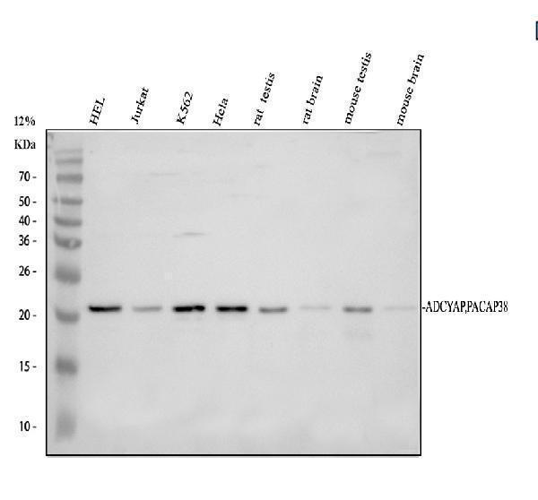 a01711 1 adcyap1 primary antibodies wb testing 1_1