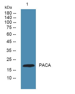 Western blot analysis of lysates from K562 cells, primary antibody was diluted at 1:1000, 4°over night