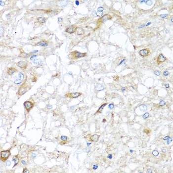 a01714 1 rac2 primary antiboties ihc testing 3