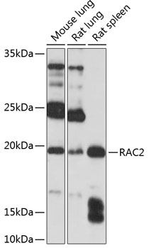 a01714 1 rac2 primary antiboties wb testing 2