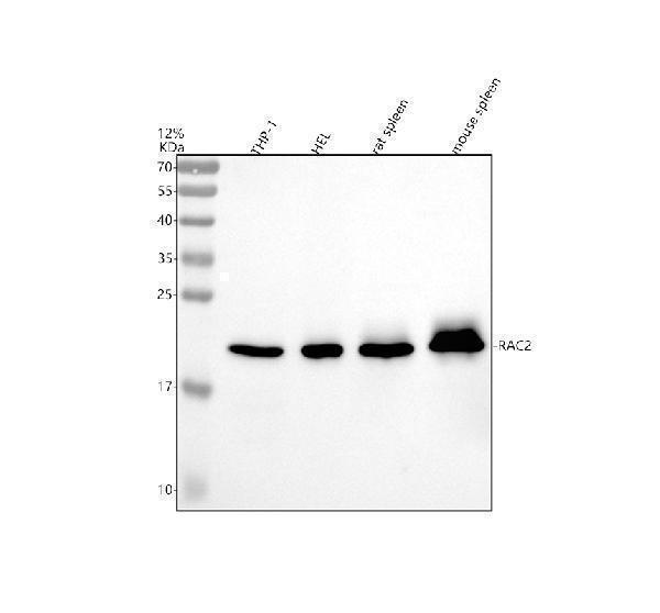 a01714 2 rac2 primary antibodies wb testing 1