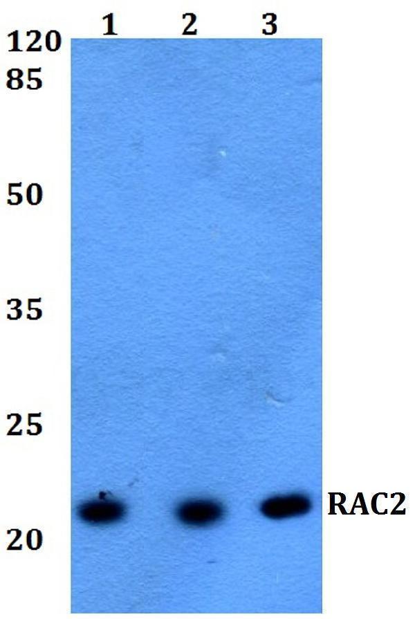 a01714 rac2 primary antiboties wb testing 1