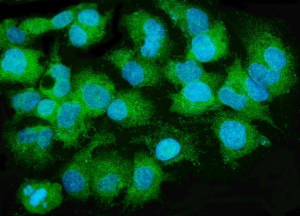 a01715 1 mttp primary antibodies if testing 4