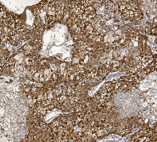 a01715 1 mttp primary antibodies ihc testing 2