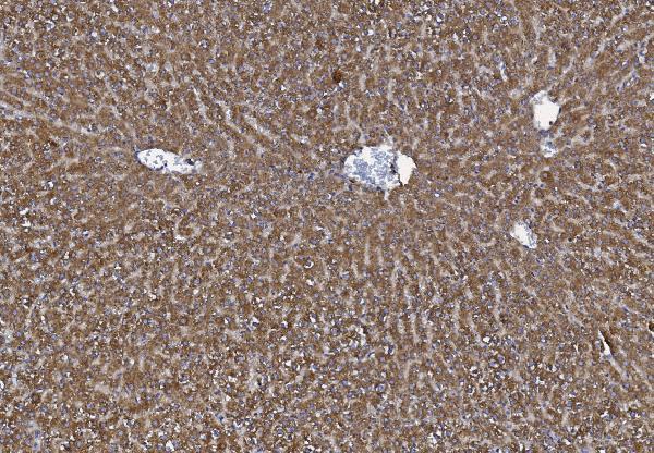 a01715 1 mttp primary antibodies ihc testing 3