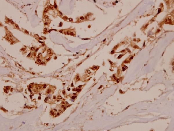 a01716 ifngr1 primary antiboties ihc testing 2