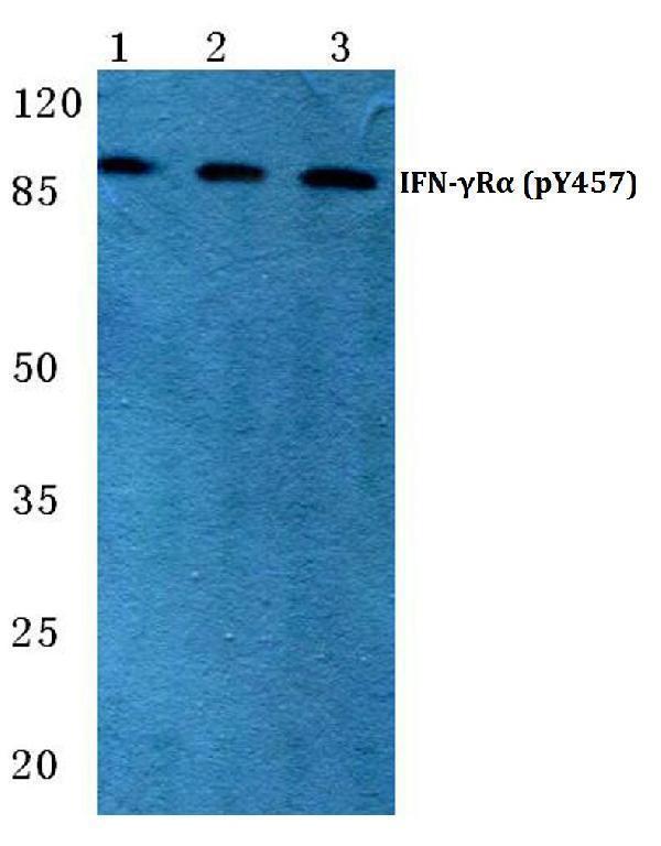 Western blot (WB) analysis of p-IFNGR1 (Y457) polyclonal antibody at 1:500 dilution
Lane1:HEK293T cell lysate treated with IFN-γ(100µg/ML,15mins)
Lane2:HNIH-3T3 cell lysate treated with IFN-γ(100µg/ML,15mins)
Lane3:H9C2 cell lysate treated with IFN-γ(100µg/ML,15mins)