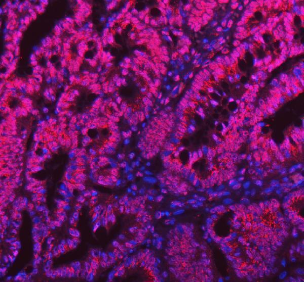 a01717 1 khdrbs1 primary antibodies if testing 11