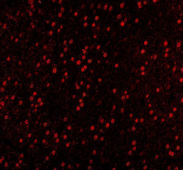 a01717 1 khdrbs1 primary antibodies if testing 12