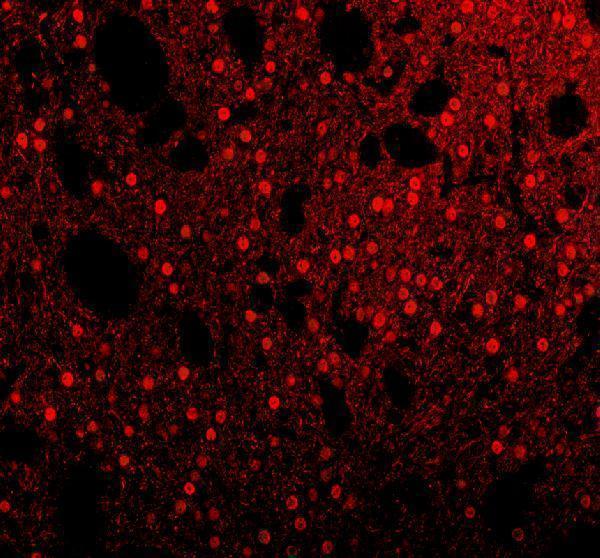 a01717 1 khdrbs1 primary antibodies if testing 13