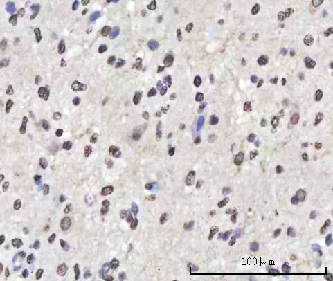  IHC analysis of Sam68/KHDRBS1 using anti-Sam68/KHDRBS1 antibody (A01717-1)