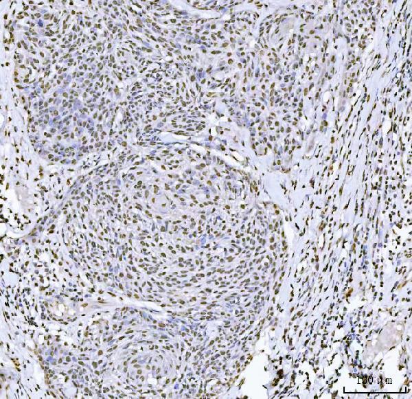 a01717 1 khdrbs1 primary antibodies ihc testing 5