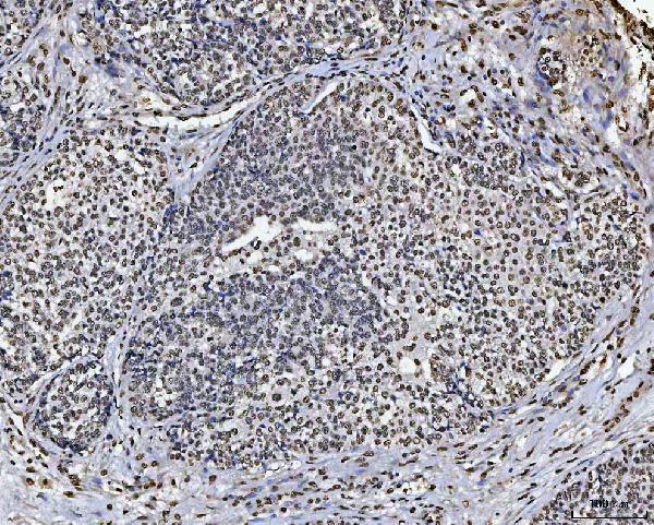 a01717 1 khdrbs1 primary antibodies ihc testing 6