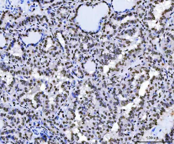 a01717 1 khdrbs1 primary antibodies ihc testing 7