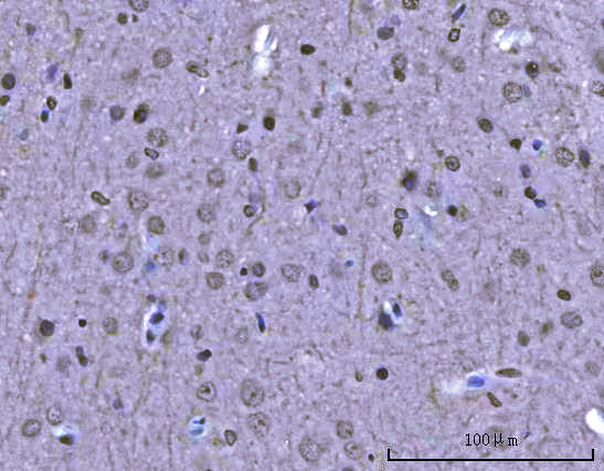 a01717 1 khdrbs1 primary antibodies ihc testing 8