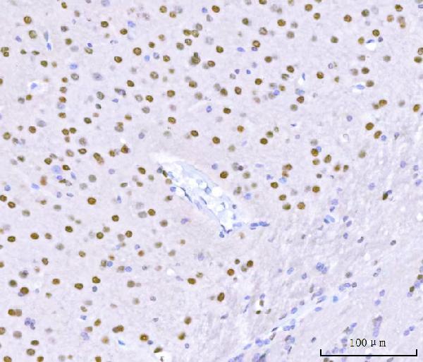 a01717 1 khdrbs1 primary antibodies ihc testing 9