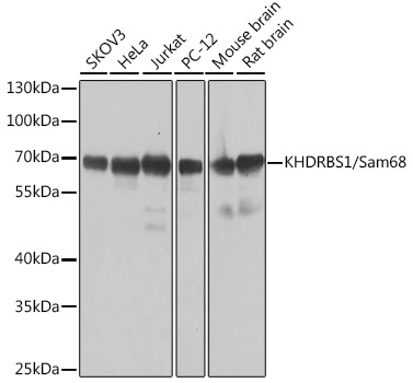 Western blot analysis of extracts of various cell lines, using KHDRBS1/Sam68 antibody  at 1:1000 dilution