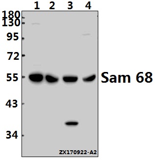 Western blot (WB) analysis of Sam 68 (Y145) pAb at 1:1000 dilution
Lane1:HCC827 whole cell lysate(40ug)
Lane2:Hela whole cell lysate(40ug)
Lane3:H9C2 whole cell lysate(40ug)
Lane4:3T3-L1 whole cell lysate(40ug)