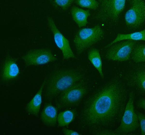 a01719 abr primary antibodies if testing 5