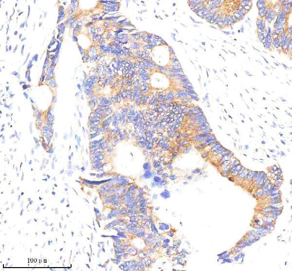  IHC analysis of ABR using anti-ABR antibody (A01719)