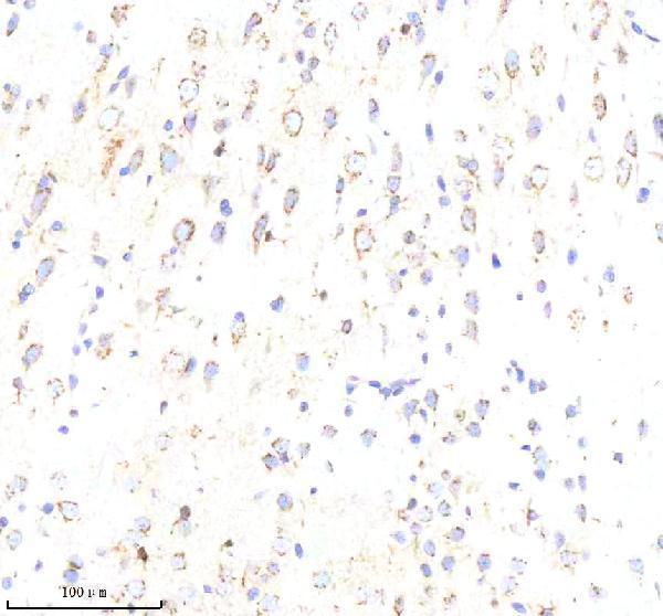  IHC analysis of ABR using anti-ABR antibody (A01719)