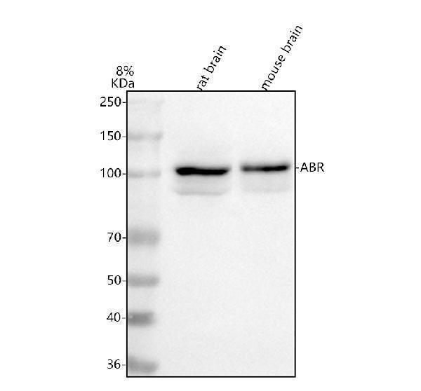  Western blot analysis of ABR using anti-ABR antibody (A01719)