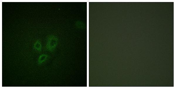 a01720 1 tnni3 primary antibodies if testing 1