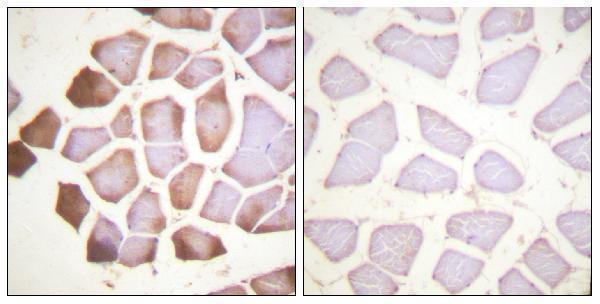 a01720 1 tnni3 primary antibodies ihc testing 2