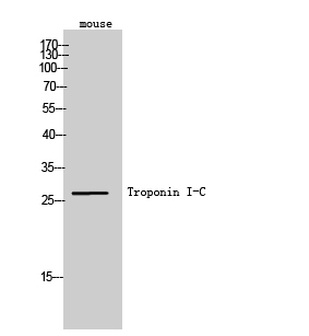 a01720 1 tnni3 primary antibodies wb testing 3
