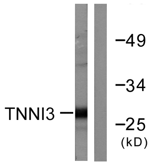 a01720 1 tnni3 primary antibodies wb testing 4