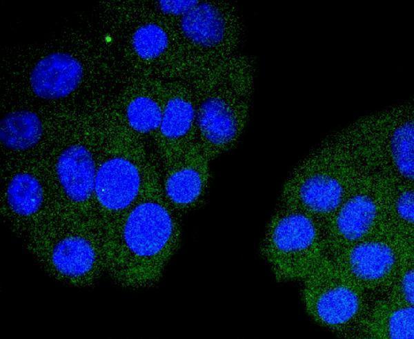 ICC staining Troponin I in HepG2 cells (red)
