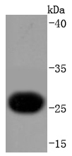 Western blot analysis of Troponin I on human heart lysates using anti-Troponin I antibody at 1/1,000 dilution