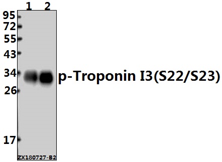 Western blot (WB) analysis of p-Troponin I3 (S22/S23) pAb at 1:500 dilution
Lane1:The Heart tissue lysate of Mouse(10ug)
Lane2:The Heart tissue lysate of Rat(10ug)