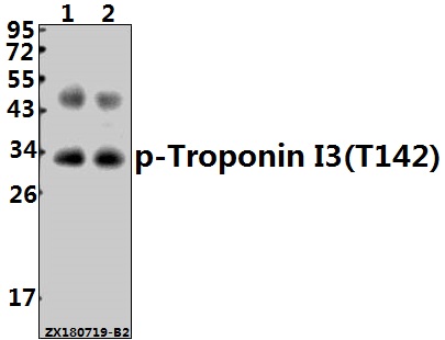 Western blot (WB) analysis of p-Troponin I3 (T142) pAb at 1:500 dilution
Lane1:The Heart tissue lysate of Mouse(40ug)
Lane2:The Heart tissue lysate of Rat(40ug)