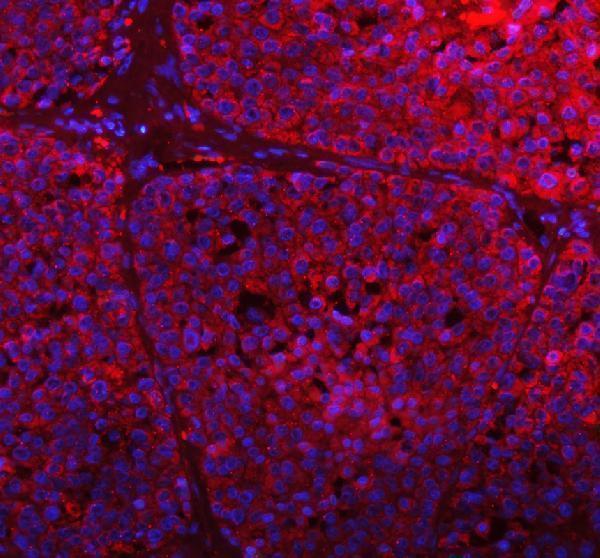 a01722 gclc primary antibodies if testing 8