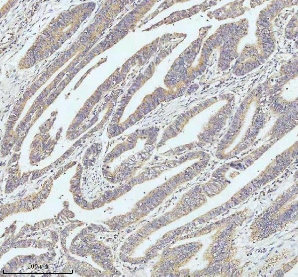 a01722 gclc primary antibodies ihc testing 2