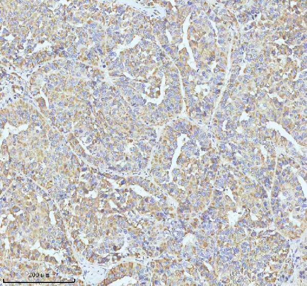 a01722 gclc primary antibodies ihc testing 4