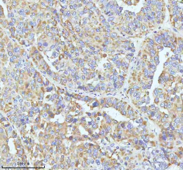 a01722 gclc primary antibodies ihc testing 5