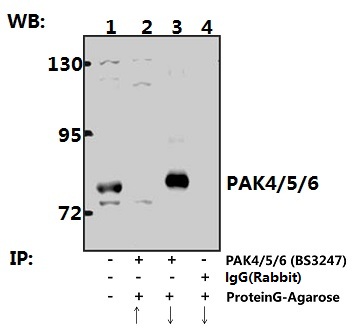 a01723 1 pak4 primary antiboties ip testing 3